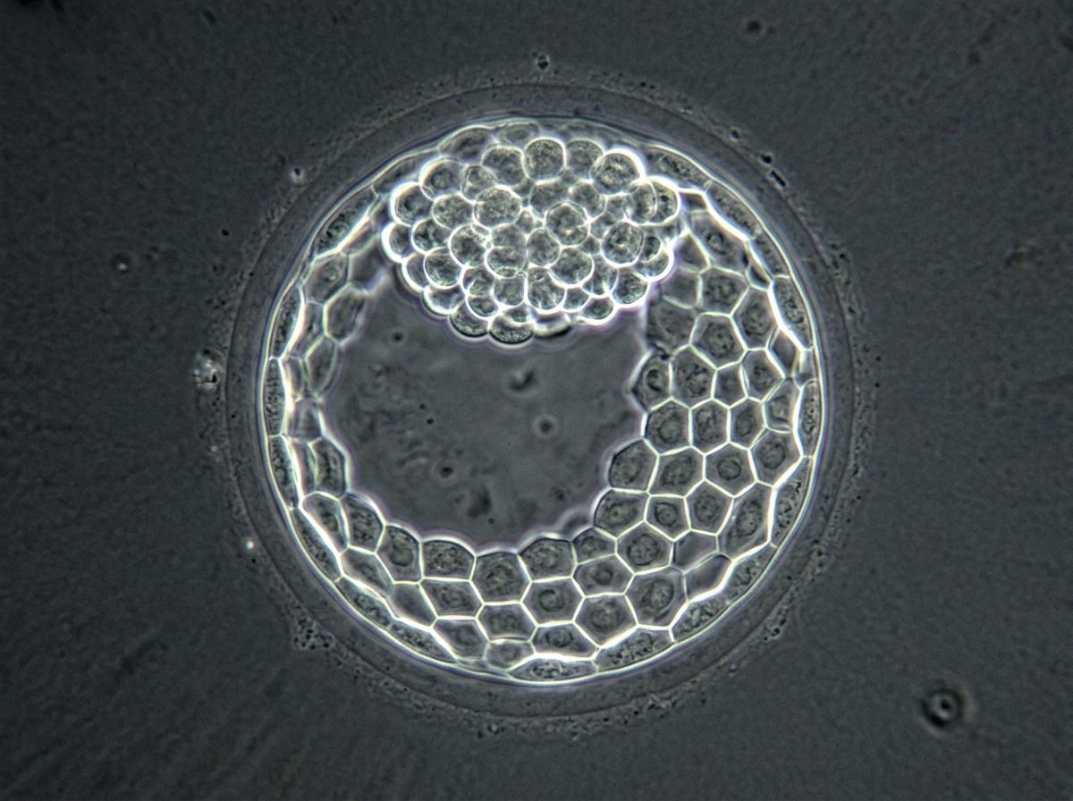Blastocyst Culture (Day 5)