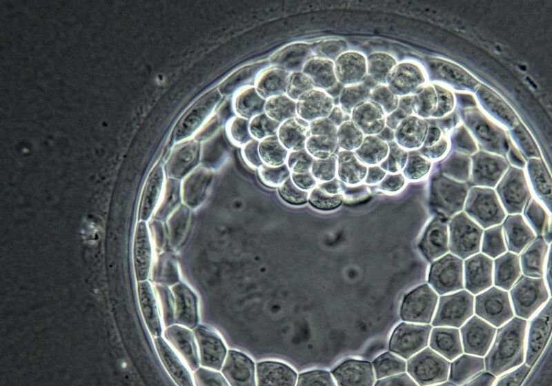 Laser-Assisted Hatching (LAH)